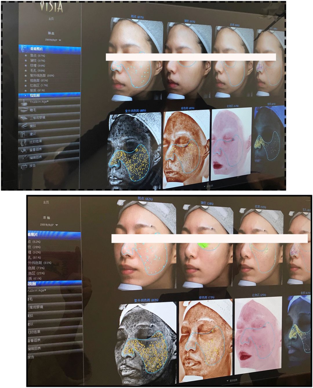 花3000块做一次皮肤护理我后悔吗,皮肤提拉效果怎么样