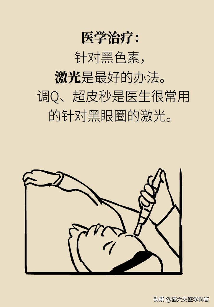 医生黑眼圈,手术消除黑眼圈靠谱吗