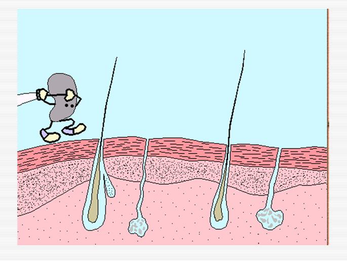 嘴巴下巴红肿痛长痘痘用什么药,下巴长痘痘又痒又痛怎么回事