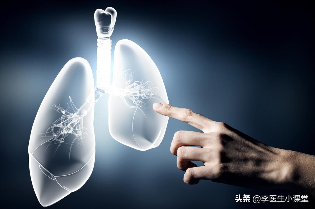 出现这些症状就要当心肺部疾病了,肺部疾病初期症状有哪些