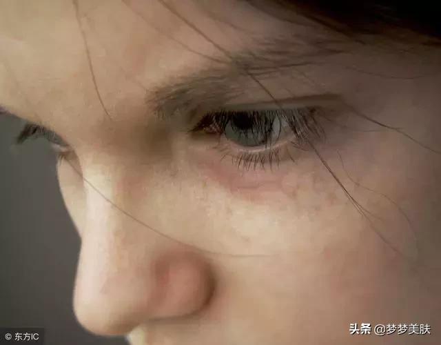 每天给眼部按摩能消除眼袋黑眼圈,一招轻松改善黑眼圈大眼袋