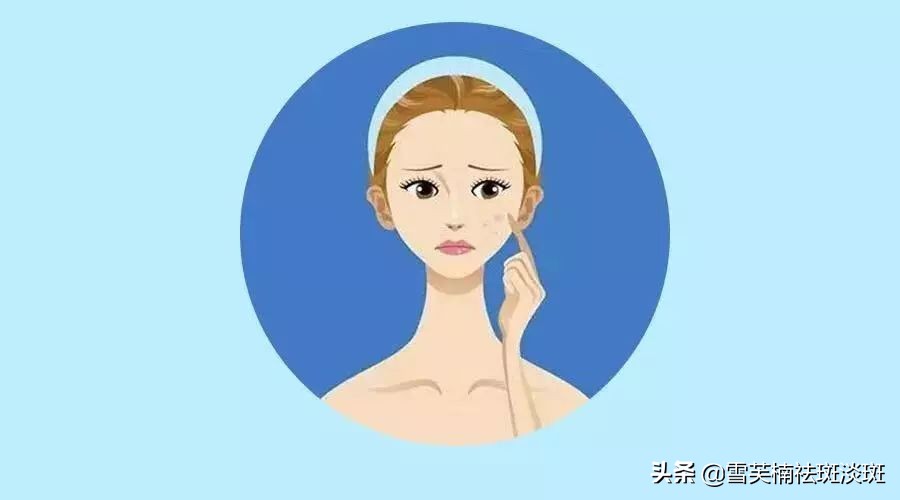 目前最有效最好的祛斑方法,目前最有效果的祛斑方法