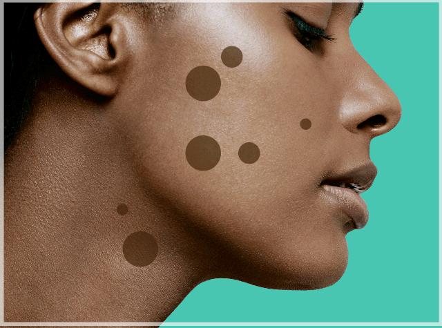 晒黑美白精华产品推荐,军训晒黑美白精华推荐