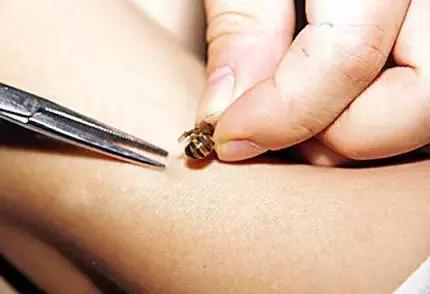 草莓蜜蜂过度授粉的危害,在草莓园被蜜蜂蛰了怎么办