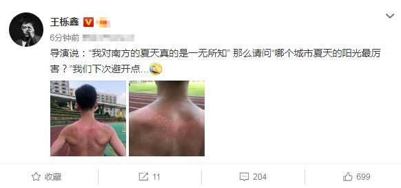 王栎鑫眼睛肿成悲伤蛙照片,王栎鑫晒照