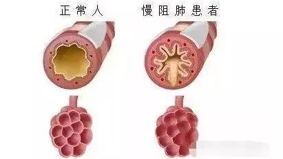 4种异常小心疾病报到莫忽视,出现这三种病征兆需要警惕