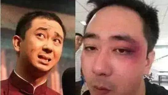 王自健为什么抑郁,王自健为何抑郁