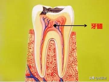 疫情牙痛怎么治疗,疫情期间牙痛用药怎么办