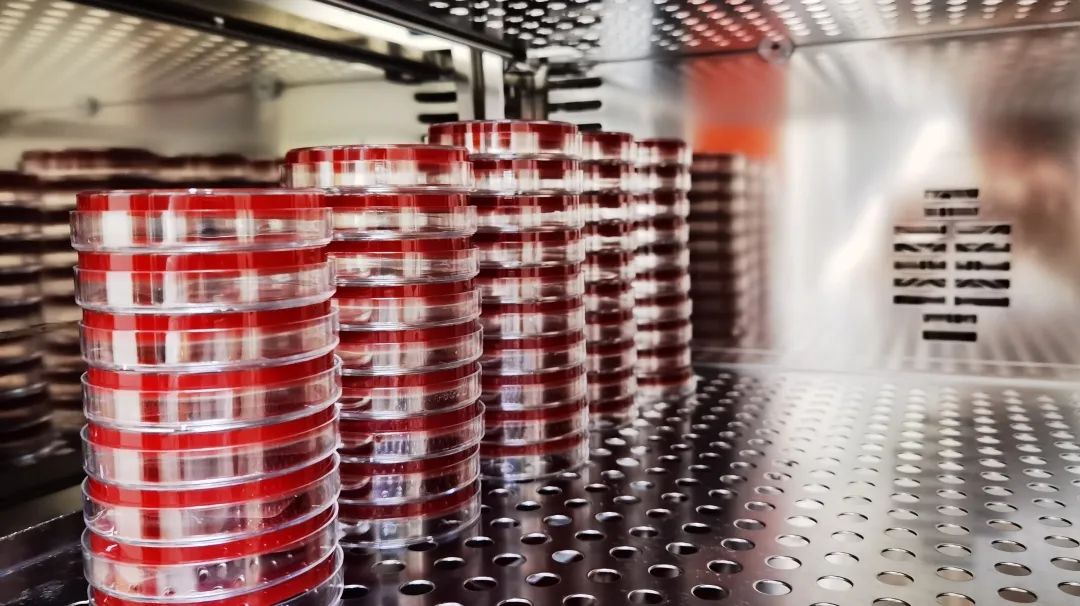 小腹痛、白带脓性,先看看这个检查