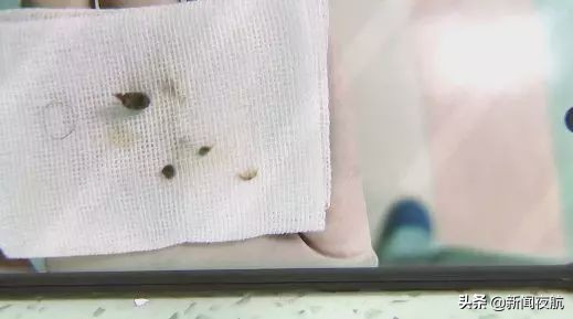 小女孩*体下**塞入异物流血不止！隔了几天走路都不对劲了