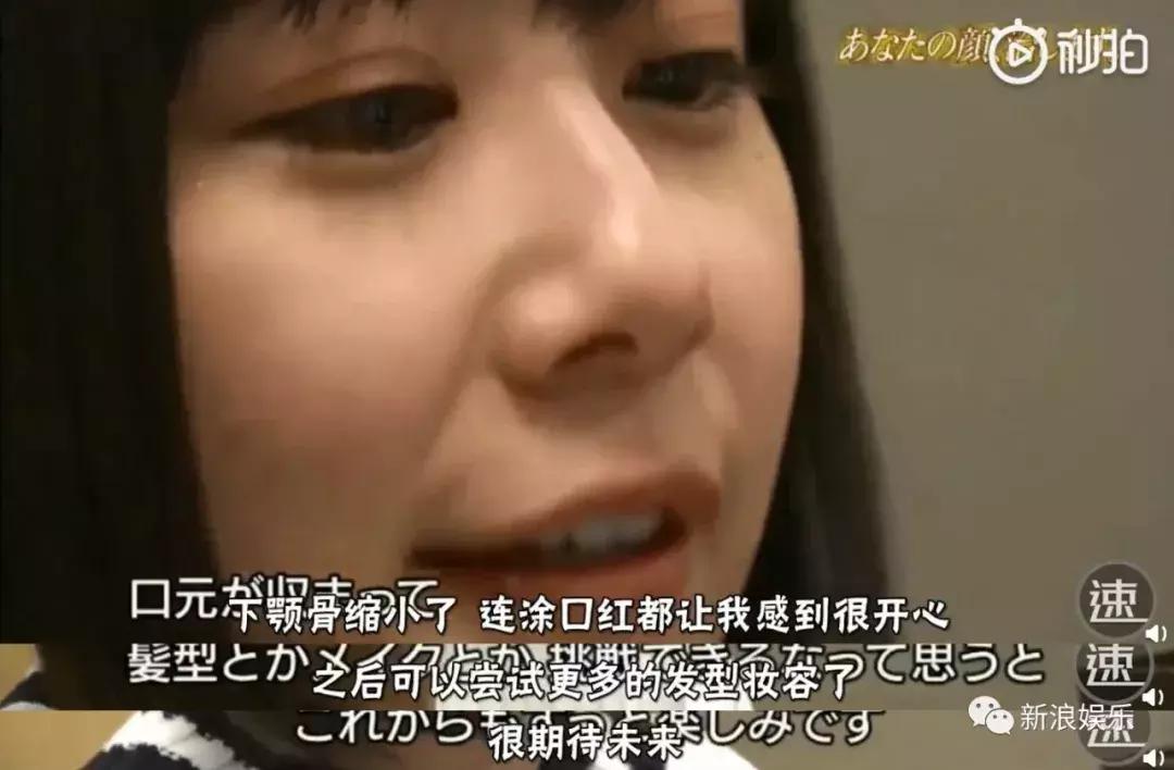 那些整容脸真的觉得自己好看吗,为什么整容以后都是一样的网红脸