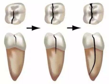 毒牙吸食者的特征,毒冰块中毒症状