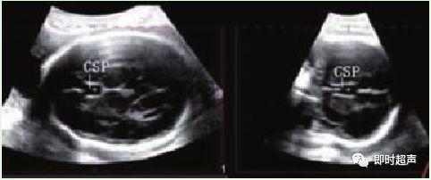 产科常规彩色超声报告单介绍,常见妇科疾病超声报告