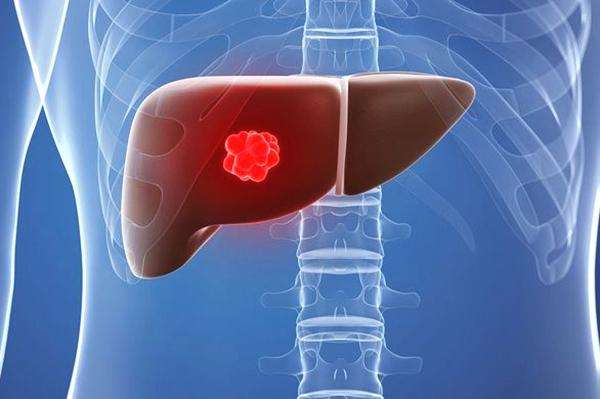 丙氨酸氨基转移酶属于血常规吗,丙氨酸氨基转移酶指标接近最高值