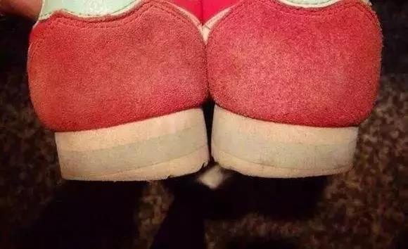 总是磨鞋底是什么原因,穿鞋老是磨鞋底后外侧的解决办法