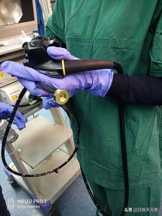 微创直肠癌造瘘,西安人民医院治愈肛瘘