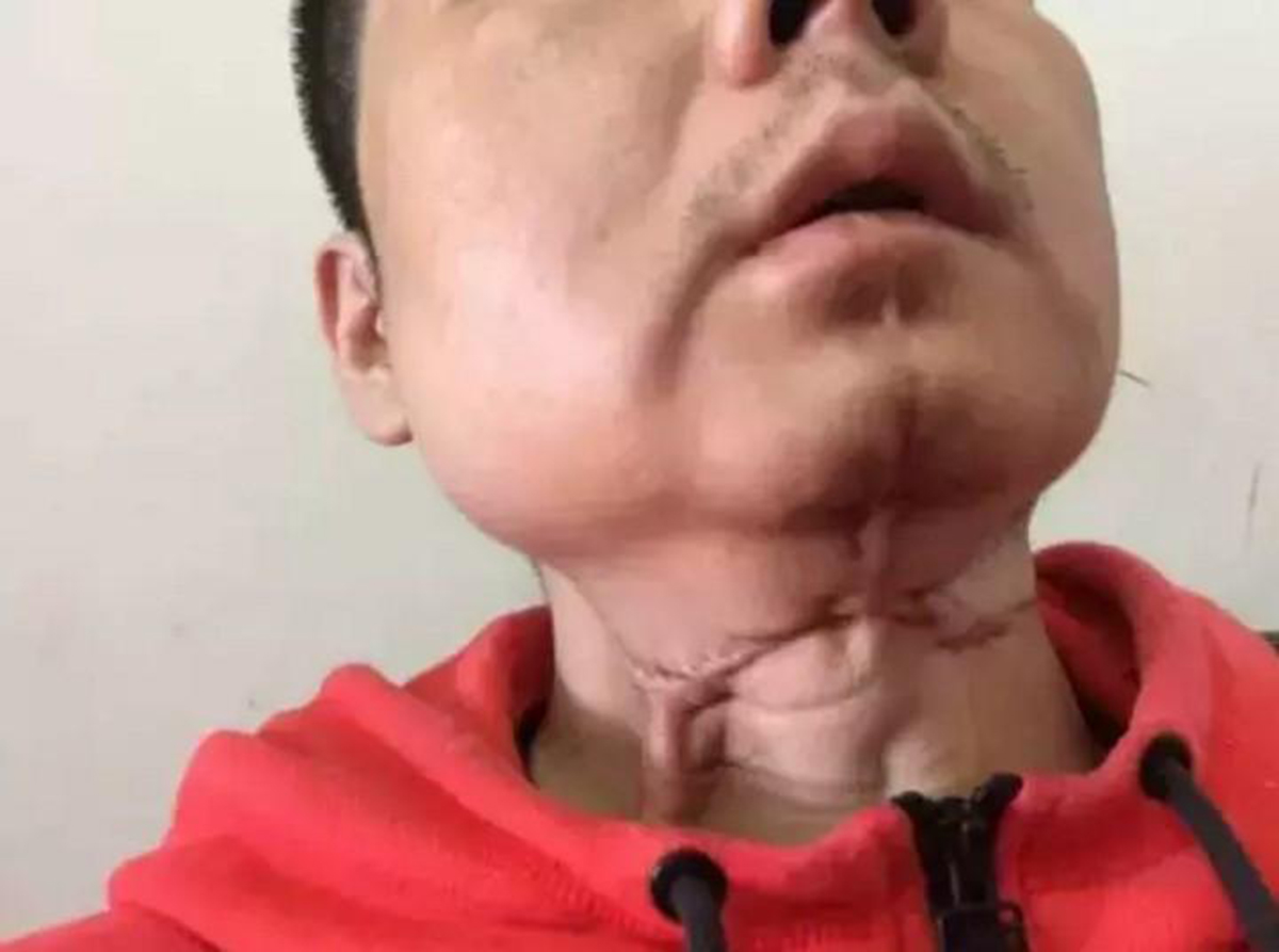 纪录片槟榔之殇,纪实记录槟榔之殇