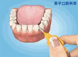 葉子口腔科普,口腔健康自查