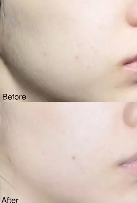 黄皮必备显白口红,黄皮必染显白发色不用漂