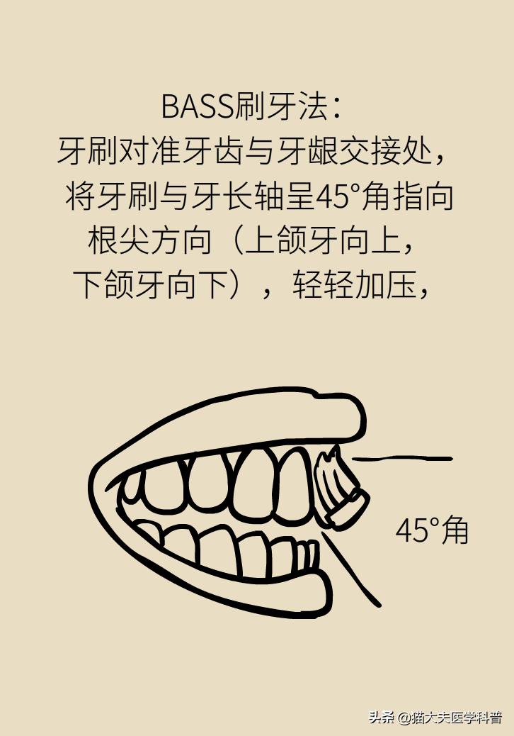 牙龈肿痛牙龈出血是啥原因引起的,牙龈肿痛出血是胃火大引发的吗