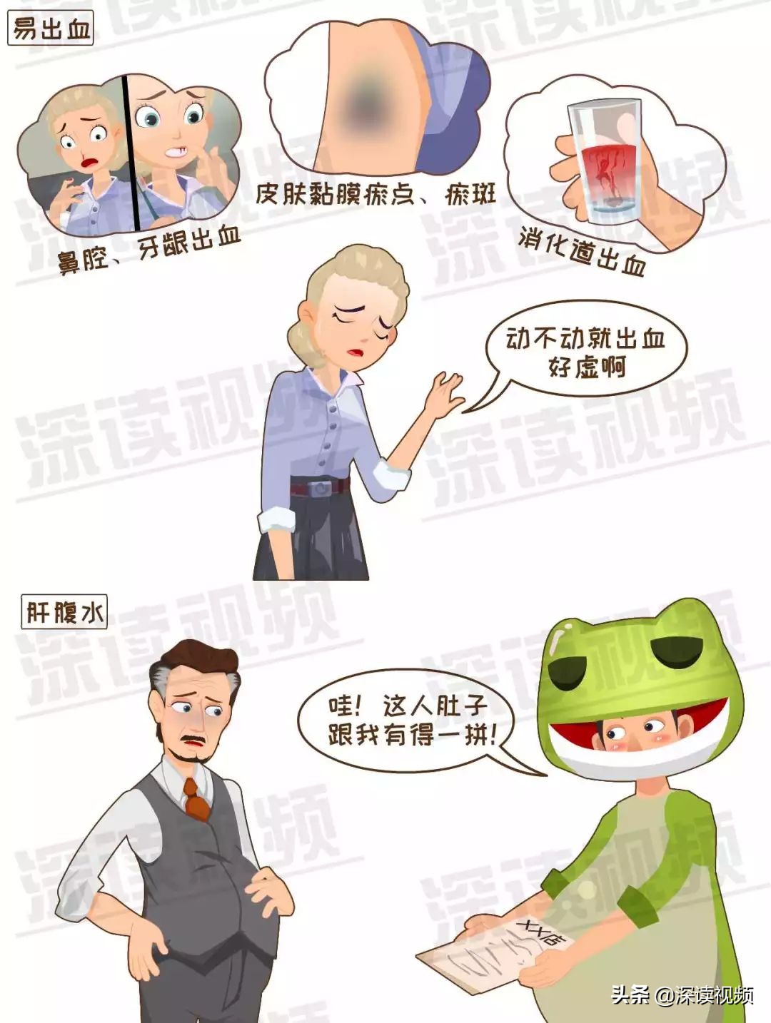 肝硬化70,肝硬化7.75严重吗