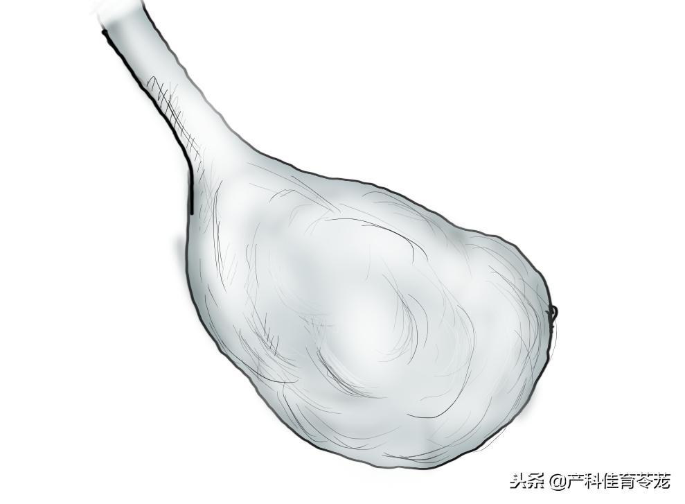 做b超能查卵巢和输卵管异常吗,b超下卵巢大小正常值是多少