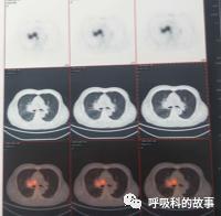 怎么应用统计学做调查,统计学方法可以解决的主要问题