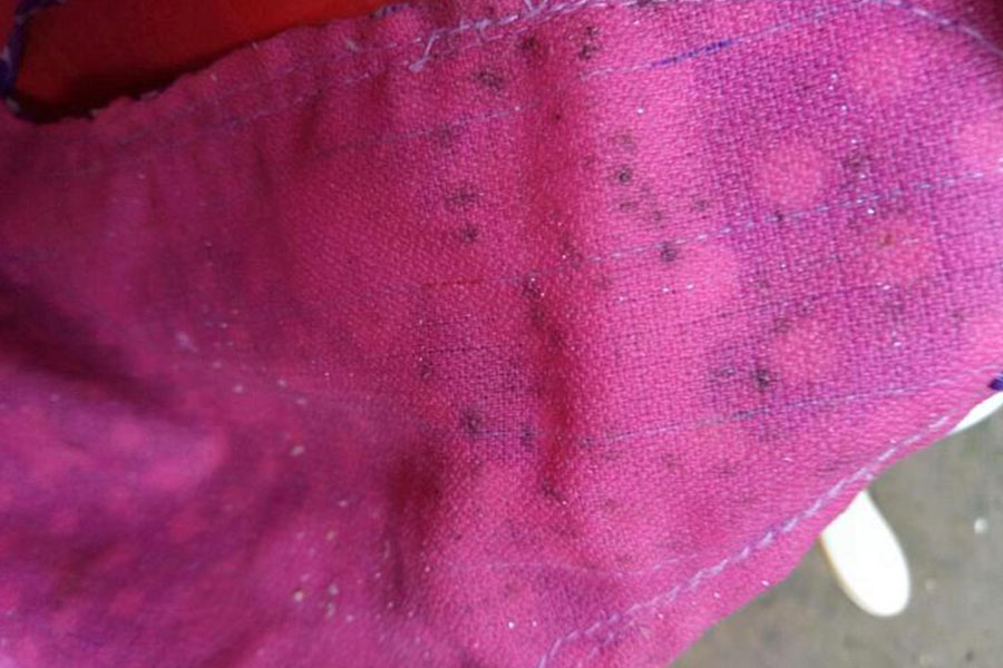 衣服上发霉了怎么处理，白醋跟牛奶可以处理，樟脑丸可以预防