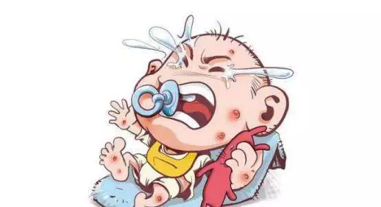 水痘年年有，今年稍稍多｜感染疾病科医生提醒：你该了解这些水痘小知识