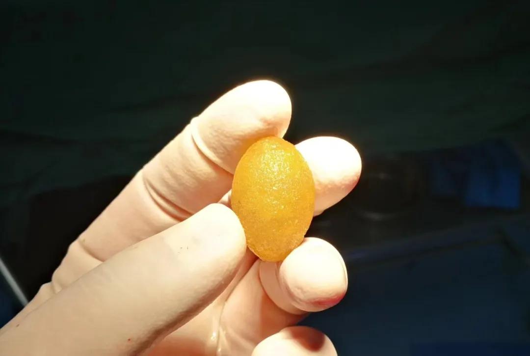 曲靖中医医院微创,曲靖市中医医院微创技术怎么样