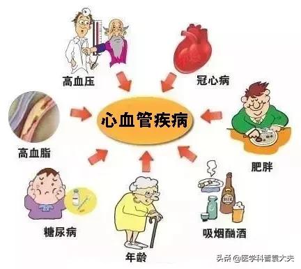 医生治疗心脑血管,医生科普心脑血管疾病