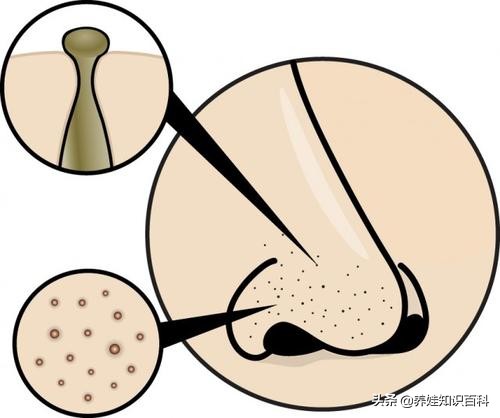 天天熬夜带娃瘦了,天天熬夜带娃也不见瘦