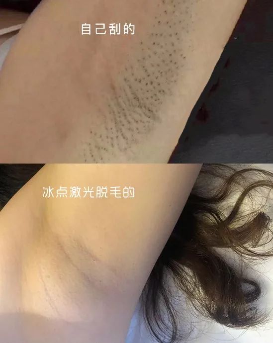 如何脱毛永远不会再长小技巧,怎么摆脱脱毛的尴尬