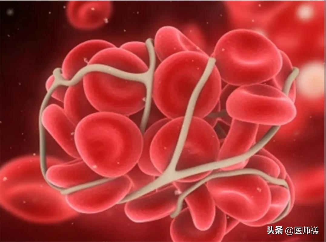 长期吃阿托伐他汀应该注意什么,长期服用阿托伐他汀会有什么后果