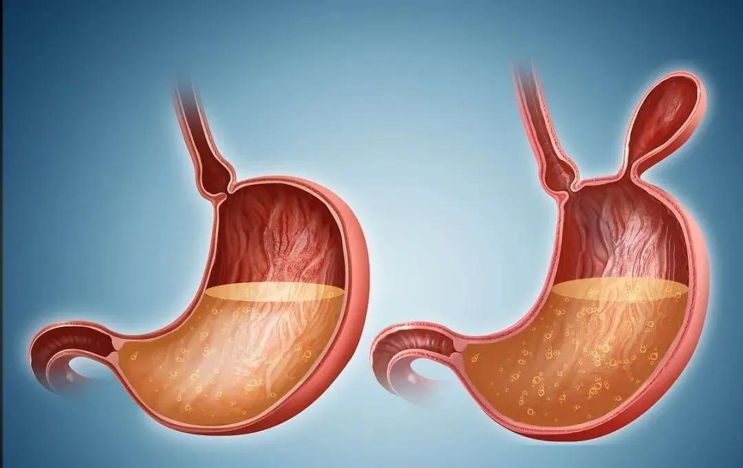 肿瘤早筛,要对症下药