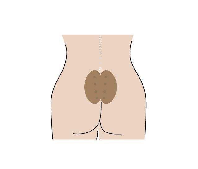 八髎穴功效与作用,男性八髎穴神奇的作用