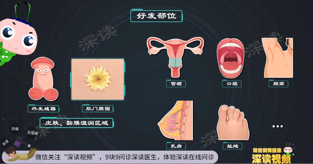 得了hpv一定会长尖锐湿疣吗,小伙口腔长尖锐病毒湿疣