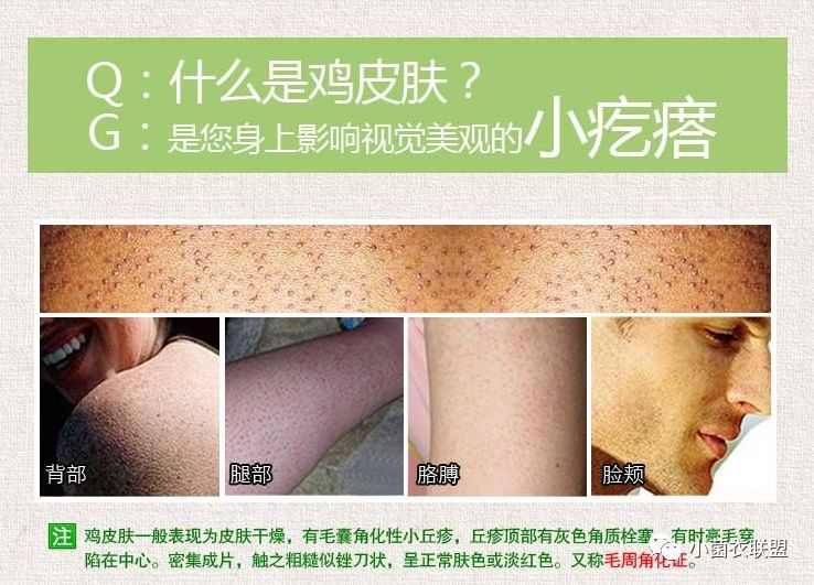 毛囊旁边长了小疙瘩不痛不痒,毛囊上肉疙瘩