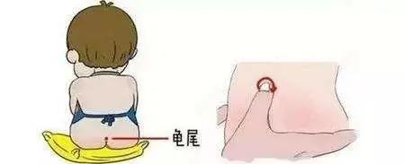 辽阳中医妙法巧治小儿腹泻，这个方法既省钱又安全