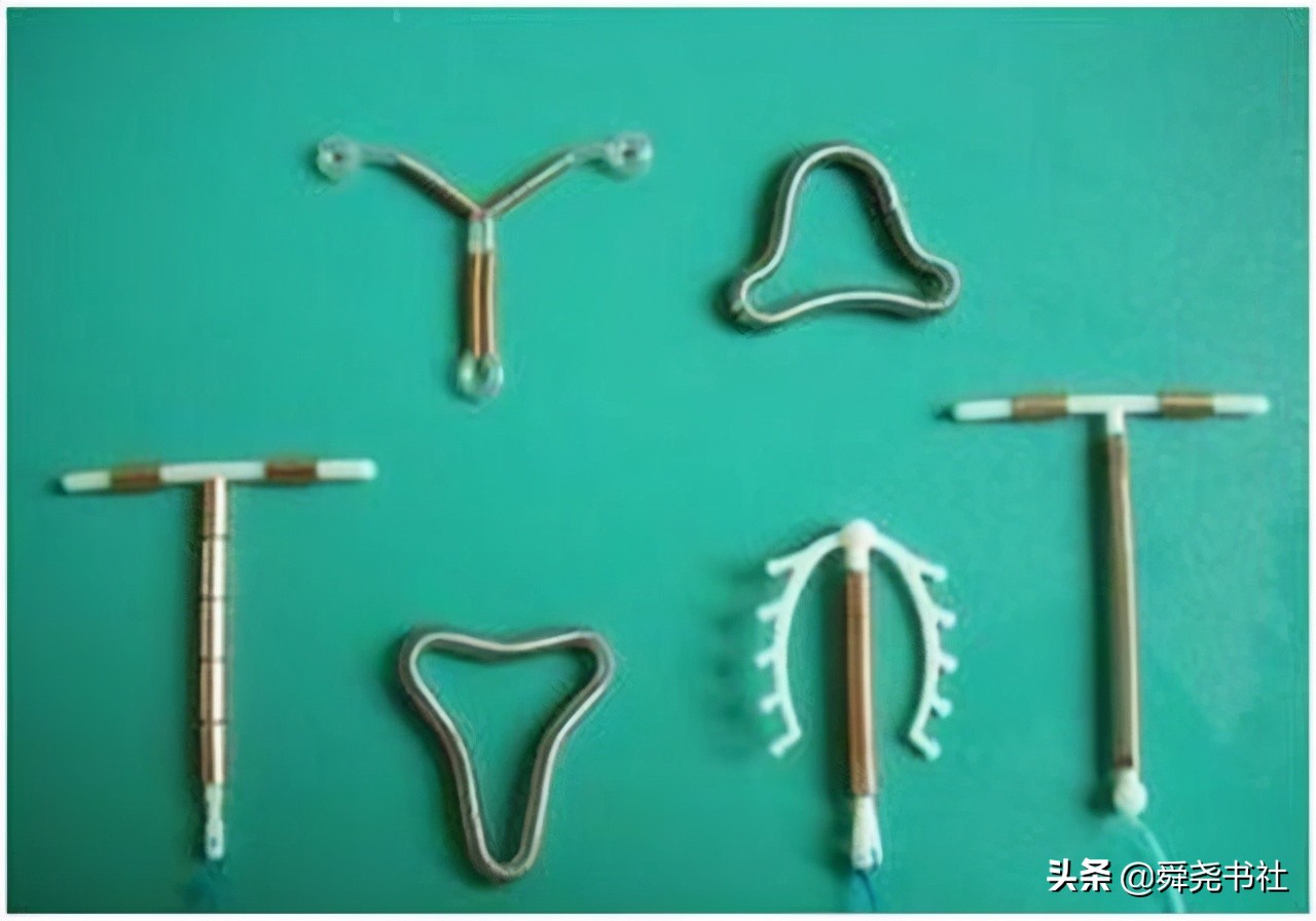 “节育环”，这种女性身体里的定时*弹炸**，你有了解吗？