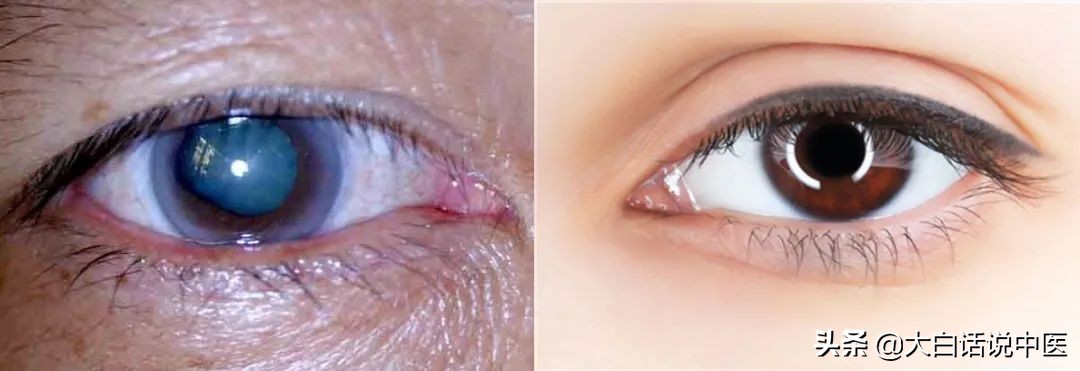 收好这份老年痴呆预防指南,如何预防老年痴呆中医