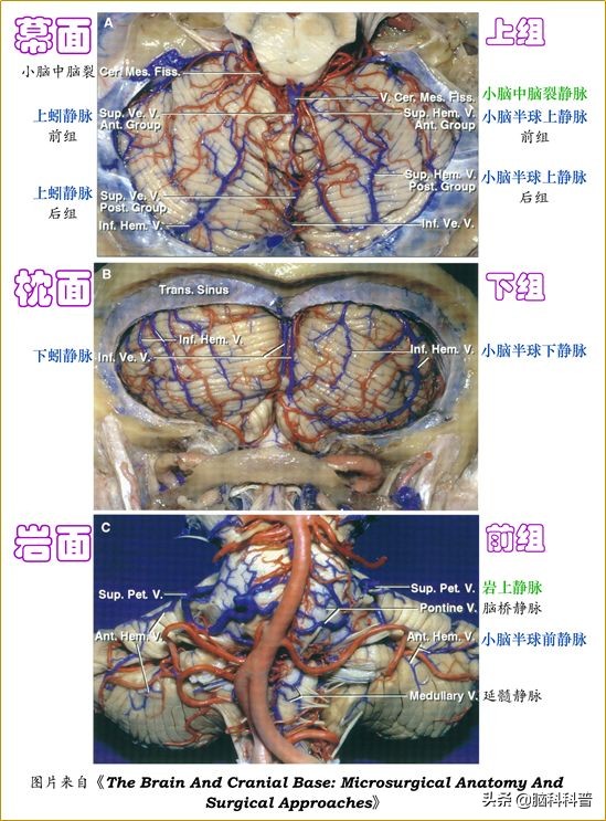 脑静脉分为深浅两支,脑静脉解剖