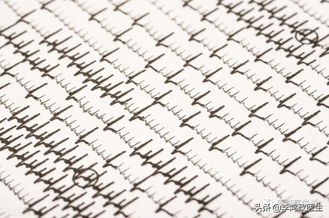 男子胸痛抢救成功,男子突发心梗医生做心肺复苏