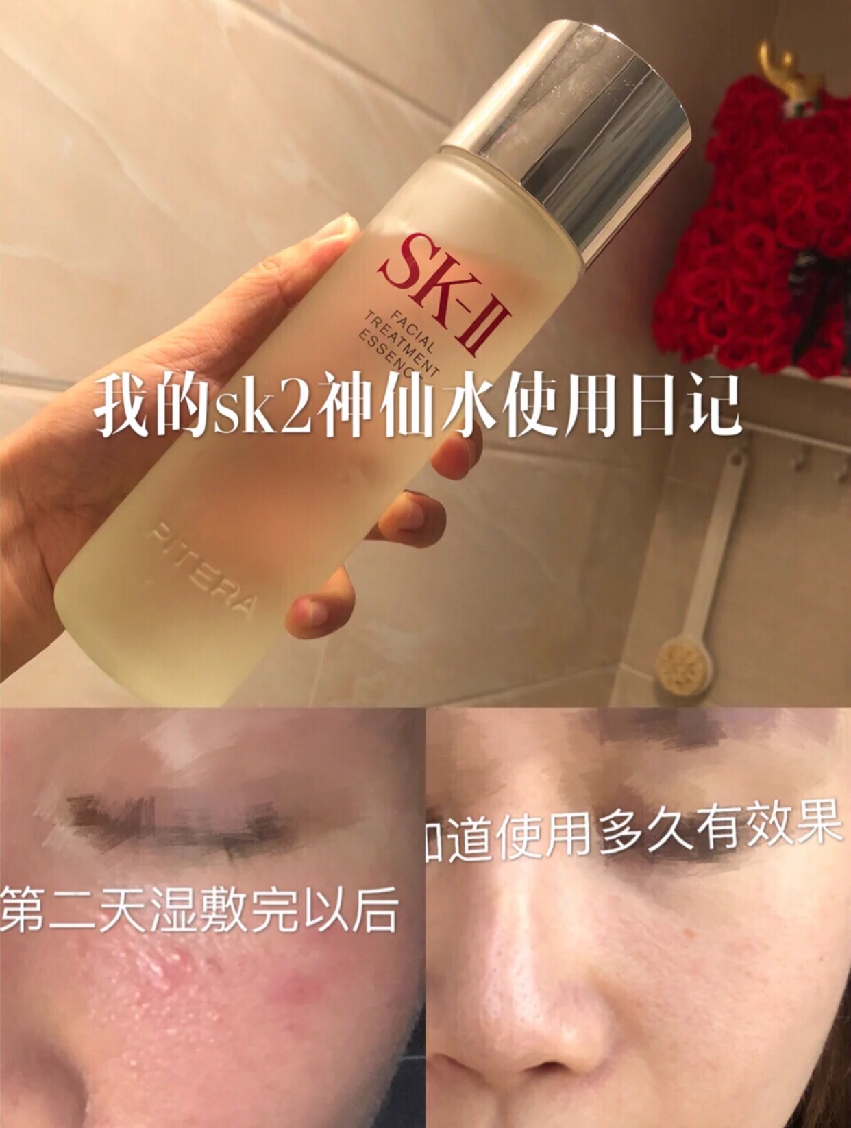 油皮适合的水乳品牌推荐夏天,日本水乳油皮