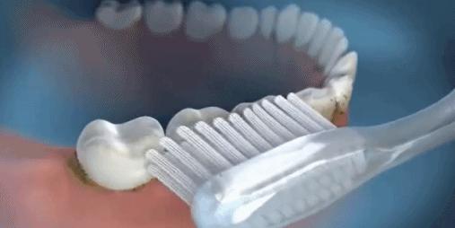 牙齿掉了要怎么做,怎么可以让牙齿掉