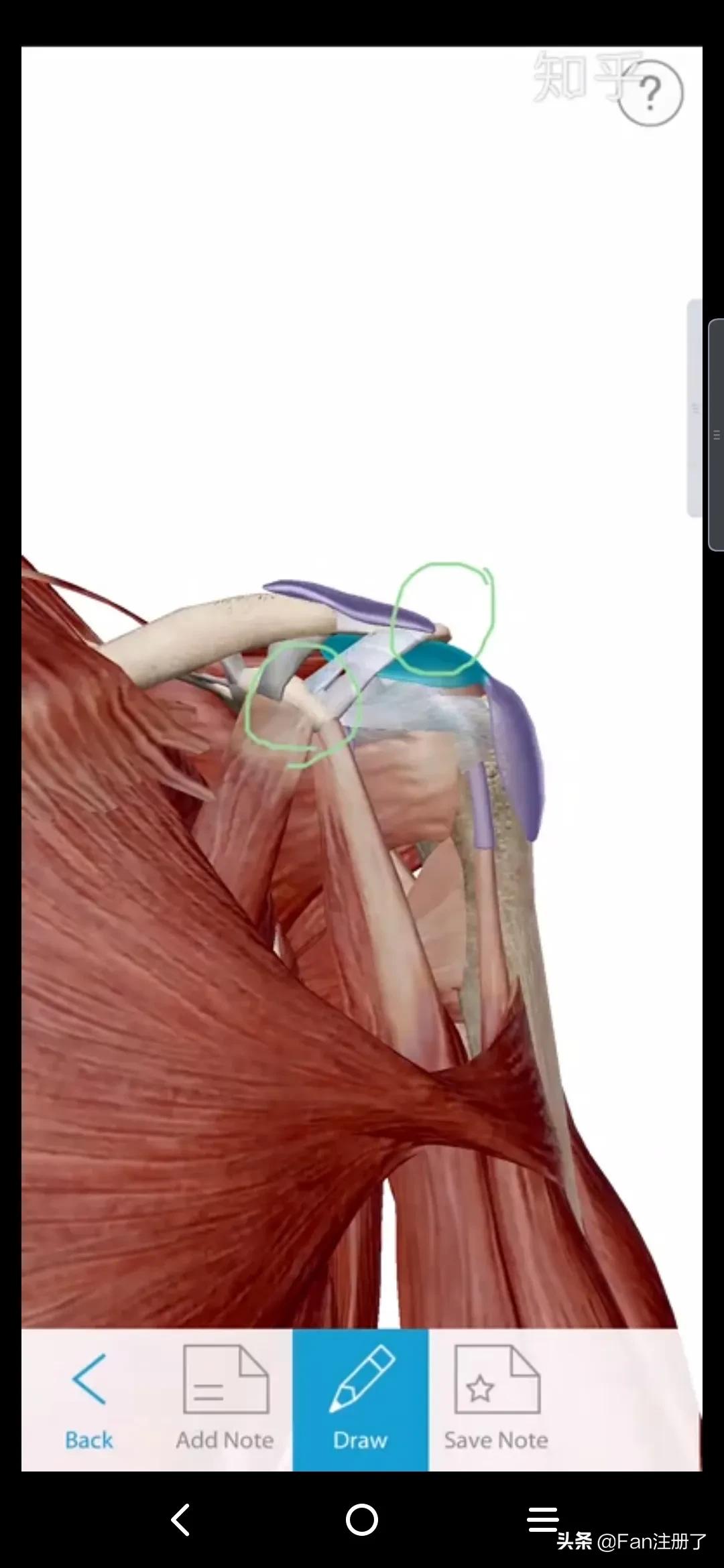 鑲╁嘲涓嬫粦鍥婄値鐥呭洜,鑲╁嘲婊戝泭鐐庝綅缃浘