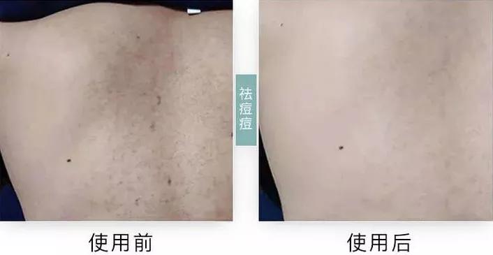 伊丽莎白雅顿身体乳绿茶500ml,伊丽莎白雅顿绿茶身体乳和润体霜