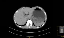 龙华区中心医院多学科协作成功救治水电解质、酸碱平衡紊乱患者