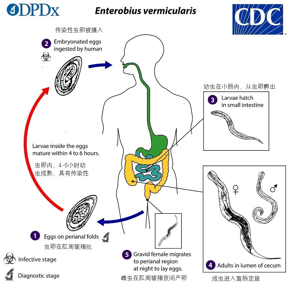 现在小学生要打虫吗,给小孩打虫的季节