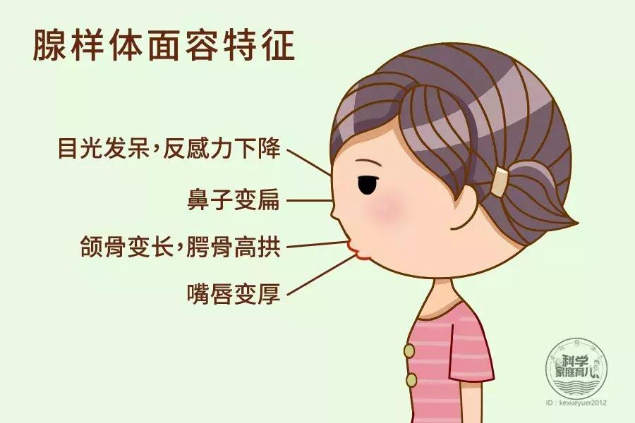 孩子鼻塞严重像打鼾怎么办,孩子鼻塞打鼾怎么缓解